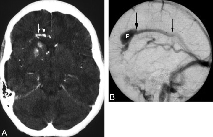 Fig 3.