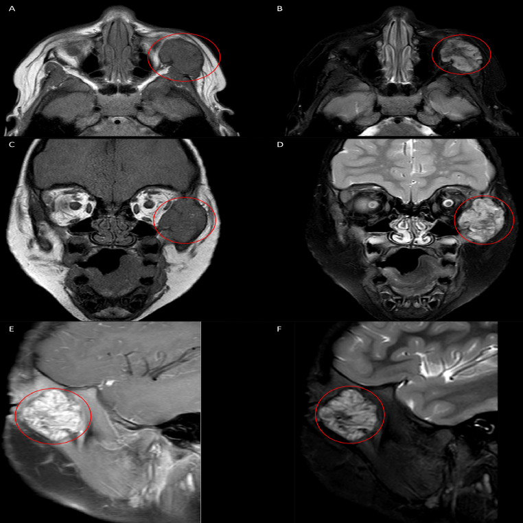 Fig. 6: