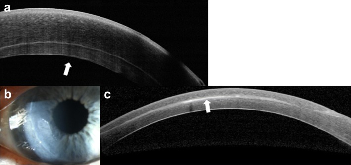 Fig. 14