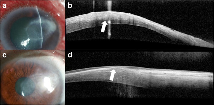 Fig. 13