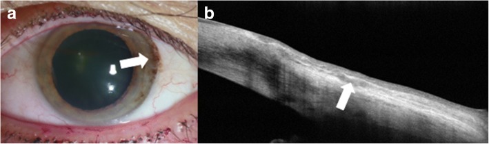 Fig. 10