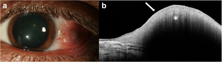 Fig. 5