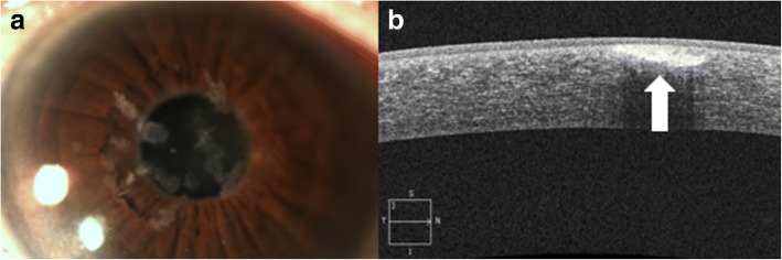 Fig. 12