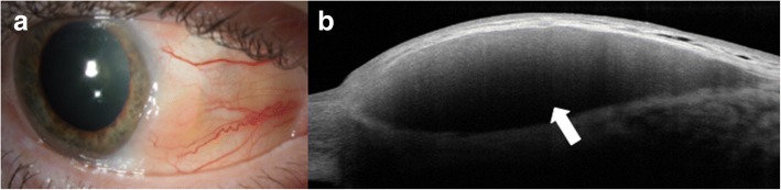 Fig. 6