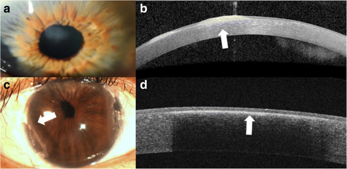 Fig. 11