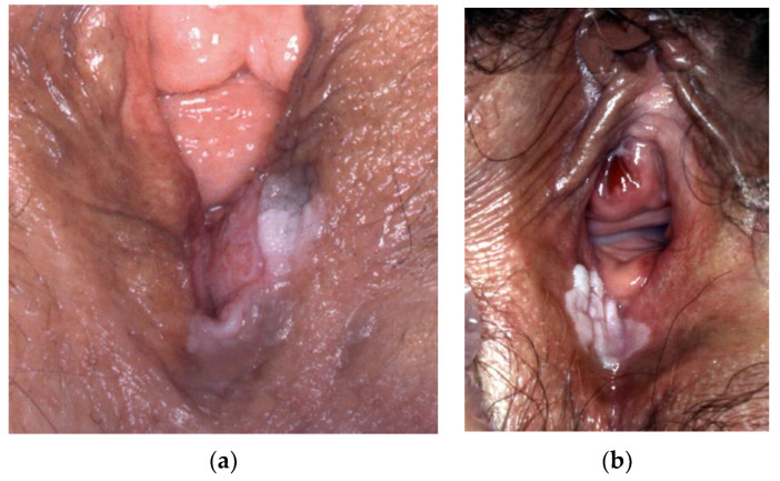 Figure 23