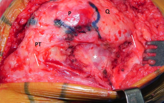 Fig. 7