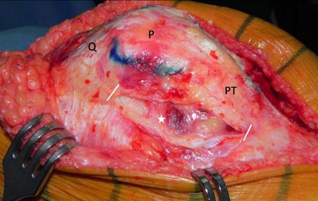 Fig. 6