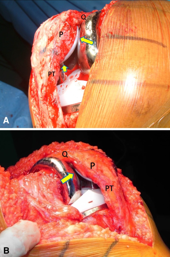 Fig. 1A–B