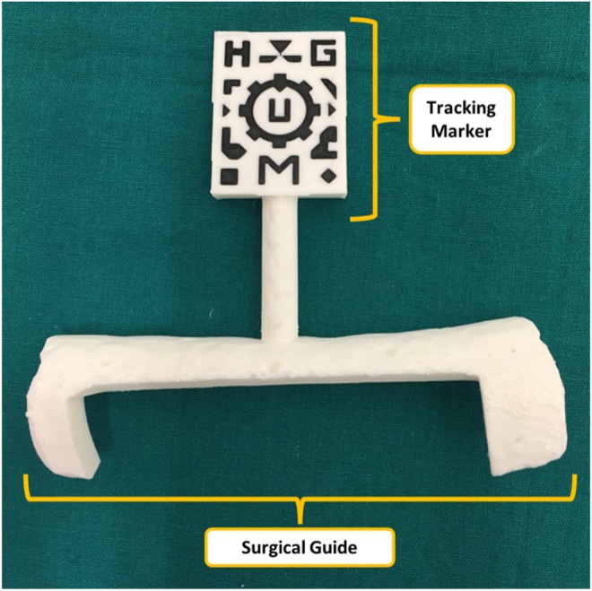 Fig. 2