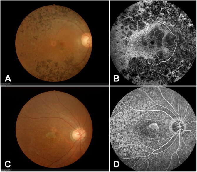 Fig 2