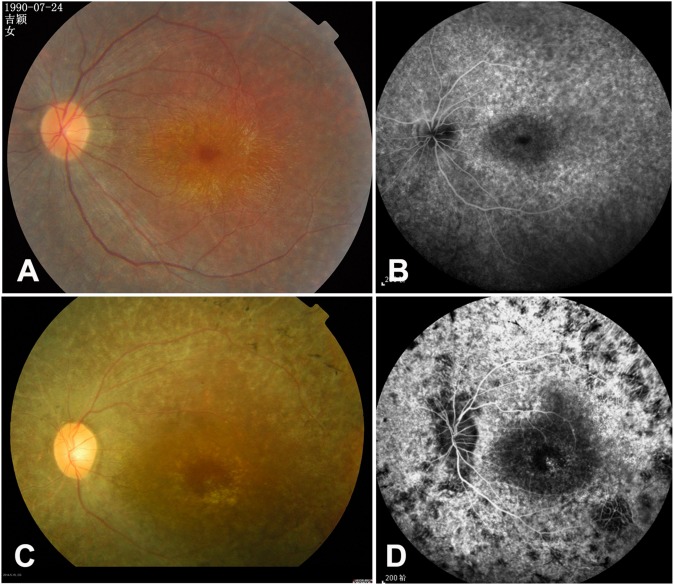 Fig 3