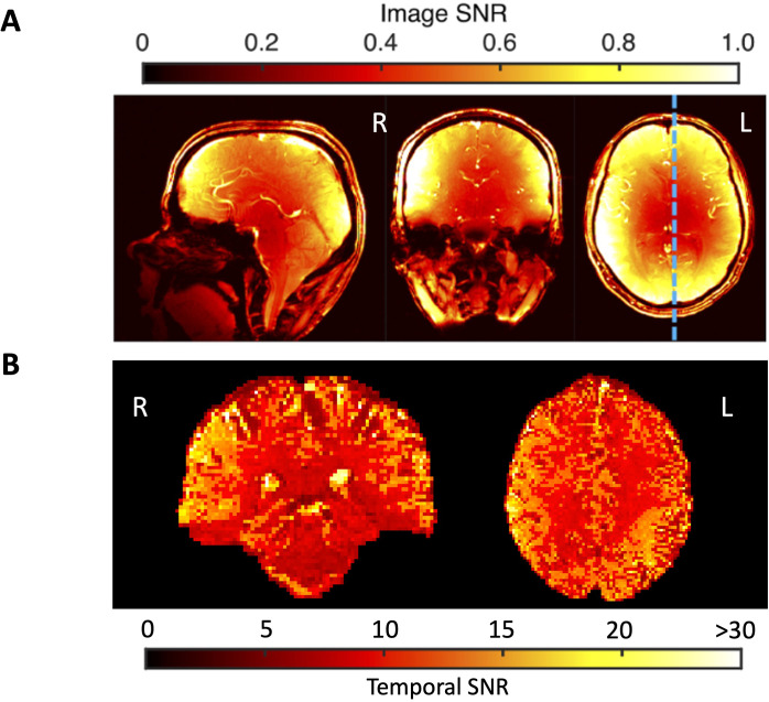 Figure 3—figure supplement 2.