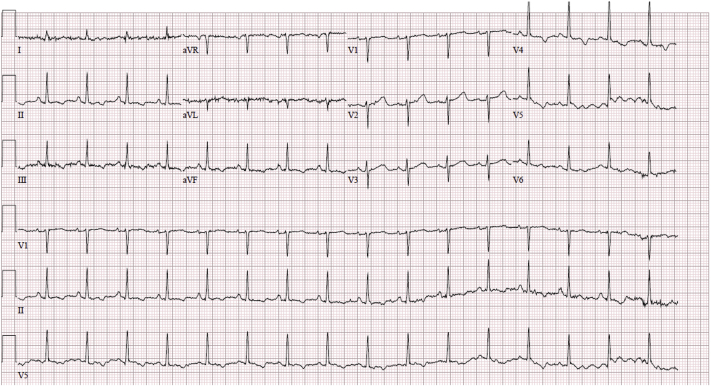 Figure 1