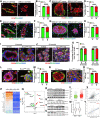 Figure 1. Disrupted mammary bilayer structure and undetermined epithelial cell fate associated with elevated St8sia4. A–D, Representative images of the tumor-adjacent mammary gland (A) and mammary tumor tissues (C) co-stained with CK18/CK14 and the quantification of the percentage of disrupted basal layer (the length of either CK14 or collagen IV–positive cells versus perimeter of the mammary duct) in the length of the mammary gland (B) and tumor tissues (n = 50 ducts/per patient; D) from non-BRCA1 mutation carriers (n = 21) and BRCA1 mutation carriers (n = 9) by ImageJ (Fiji). Scale bar, 10 μm. E–H, Representative images of tumor-adjacent mammary glands (E) and mammary tumor tissues (G) co-stained with CK18/collagen IV, and the quantification of the percentage of disrupted basal layer in length in mammary glands (F) and tumor tissues (n = 50 ducts/per patient; H) from non-BRCA1 mutation carriers (n = 21 samples) and BRCA1 mutation carriers (n = 9 samples). Scale bar, 10 μm. I–K, Representative images of WT and MT tumor-adjacent mammary gland (I) and breast tumor tissues (J) co-stained with CK18 and CK14 and quantification of the percentage of the disrupted basal layer in length (K) from 8 and 10-month-old Brca1MKO mice and control mice (n = 6 mice/group and 50 ducts/mouse were counted). Arrowheads, basal layer cells. Scale bar, 20 μm. L and M, Representative images of 10-month mammary gland tissues (L) co-stained with CK18 and CK14 and quantification of the percentage of the disrupted basal layer (M) in length (n = 8–10 mice/group and 150 ducts/mouse were counted; L). Arrowheads, basal layer cells. Scale bar, 20 μm. N and O, Representative images of tumor tissues from control mice and Brca1MKO mice (N) and quantification of the percentage of the disrupted basal layer in length (n = 8–10 mice/group and 150 ducts/mouse were counted; O). Arrowheads, basal layer cells. Scale bar, 20 μm. P, The top 20 cytokines from 97 cytokine arrays probed with the serum of 6-month-old WT and Brca1MKO mice presented by heat map (n = 3 mice/group). Q, The comparison of mRNA expressions of 22 sialyltransferases in B477 and G600 mammary epithelial cell lines as determined by qPCR and presented by volcano plot. R and S, Protein levels of E-Selectin, L-Selectin, and St8sia4 in age-matched WT mammary tissues and tumor tissues from Brca1MKO mice (R), and the B477 control and G600 Brca1-MT cell lines by Western blots (n = 3–6 mice/group; S). T and U, Protein levels of ST8SIA4 in MCF10A185 (T), HCC1937 cell lines (U), and their controls as determined by Western blots. V, TNM box plots of ST8SIA4 gene expression in human normal (n = 403 patients) and breast tumor tissues (n = 1,097 patients); P = 2.63e−12. W, Violin plots of ST8SIA4 expressions in patients with breast cancer with WT BRCA1 (n = 431) and patients with low expression of BRCA1 (n = 361); P = 0.0002. X, Correlation expression between ST8SIA4 and SELE in general patients with BRCA (n = 1,100) from TCGA database. Y, Correlation expression between ST8SIA4 and SELE in patients with BRCA-basal cancer (n = 191) from TCGA database. Data are presented as means ± SD and P values determined by an unpaired Student t test (B, D, F, H, K, M, and O) and one-way ANOVA (O). ***, P < 0.001; ****, P < 0.0001.