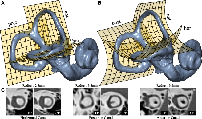 FIG. 1