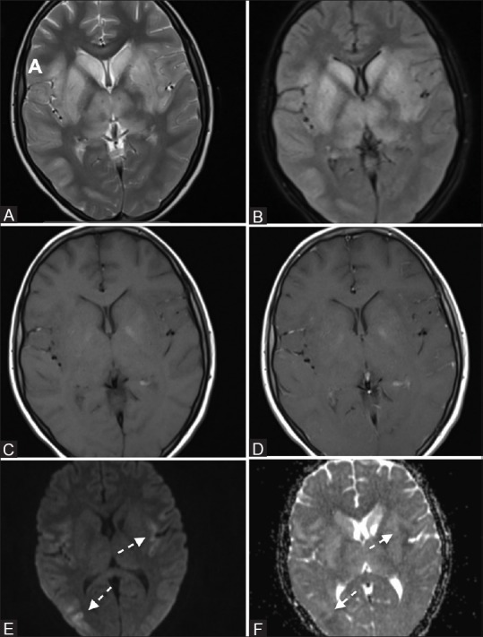 Figure 1 (A-F)