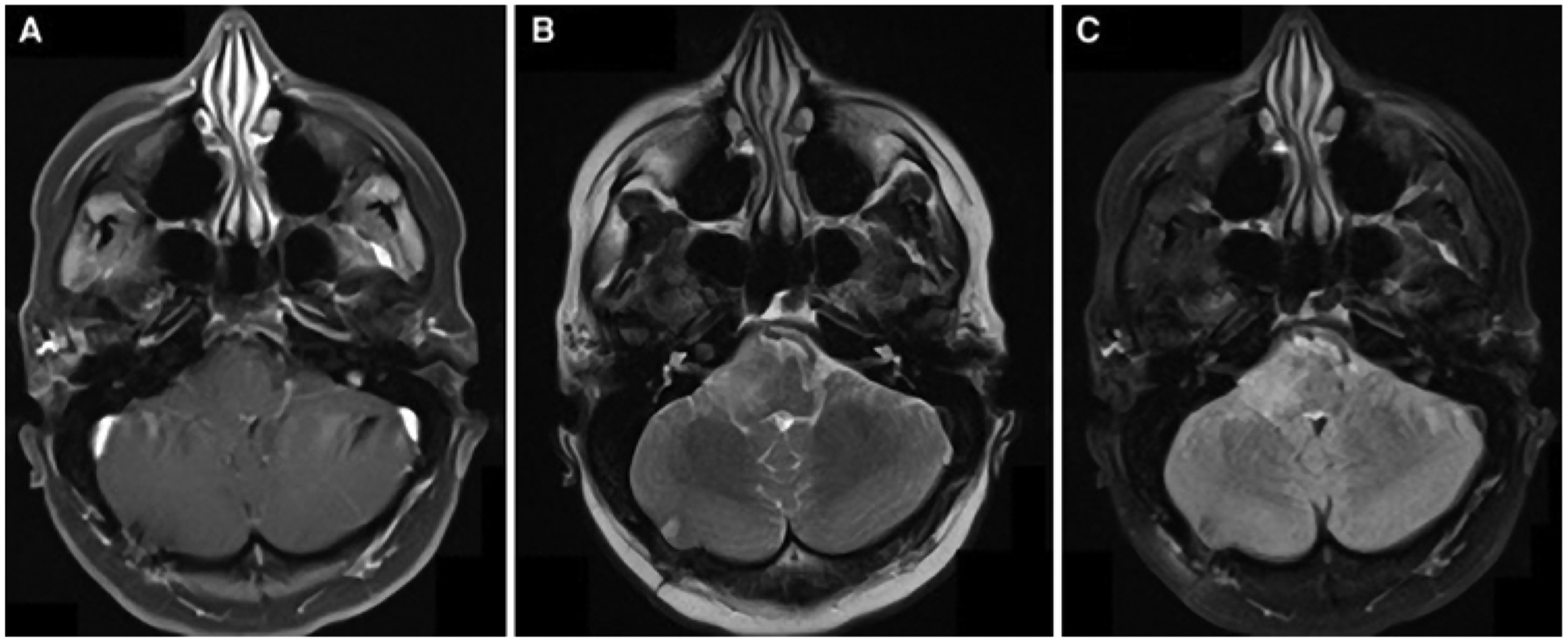 FIG. 1.