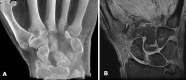 Fig. 11A–B