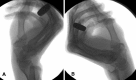 Fig. 12A–B