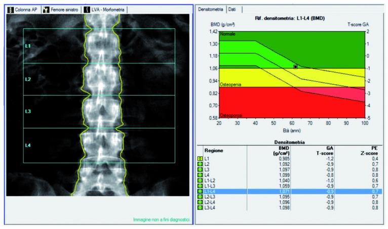 Figure 1a.