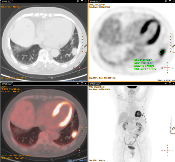 Figure 4