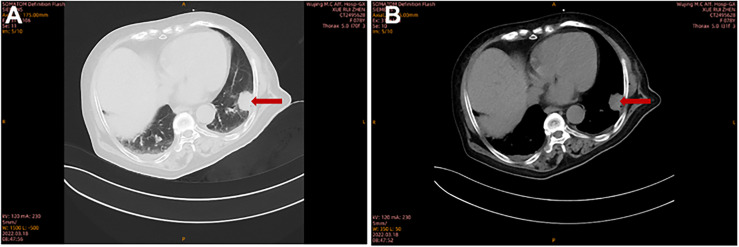 Figure 1