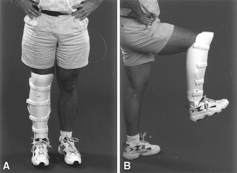 Fig. 1A–B