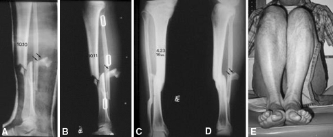 Fig. 7A–E