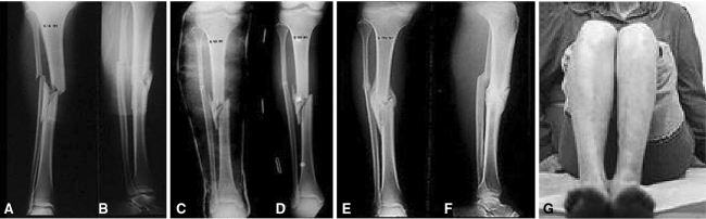 Fig. 8A–G