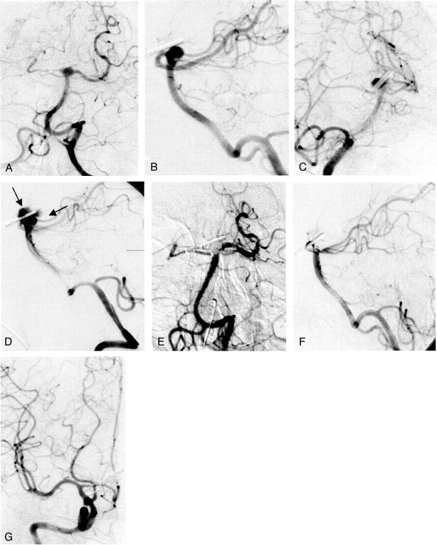 Fig 5.