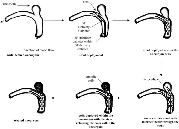 Fig 2.