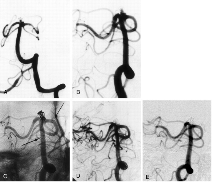 Fig 6.