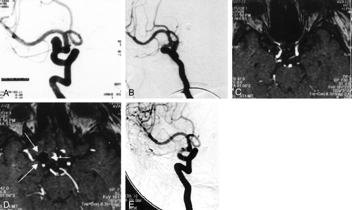 Fig 3.