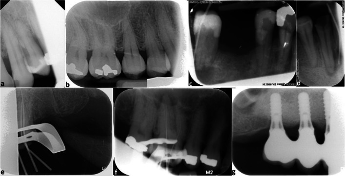 Fig. 5