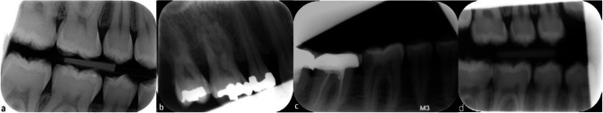 Fig. 7