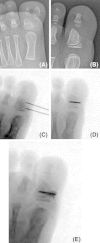 Fig. 7