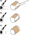 Fig. 4