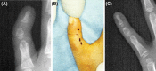 Fig. 9