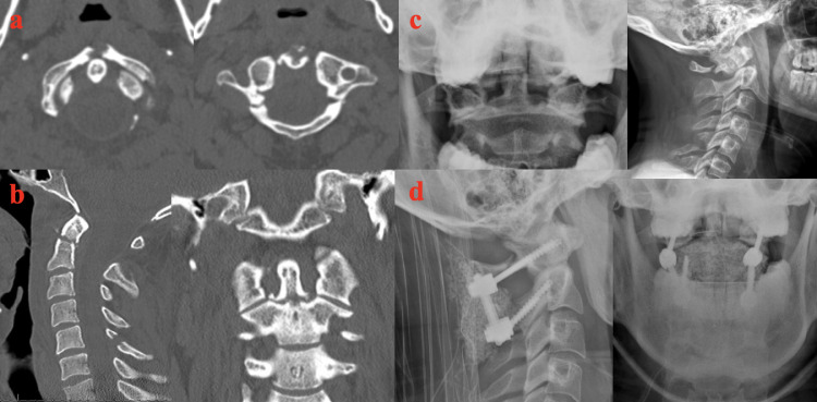 Fig 2