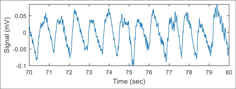 Figure 11