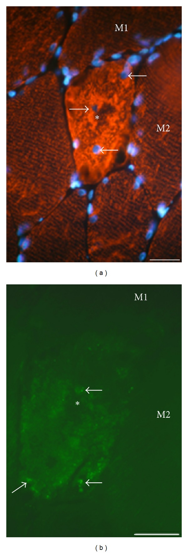 Figure 11