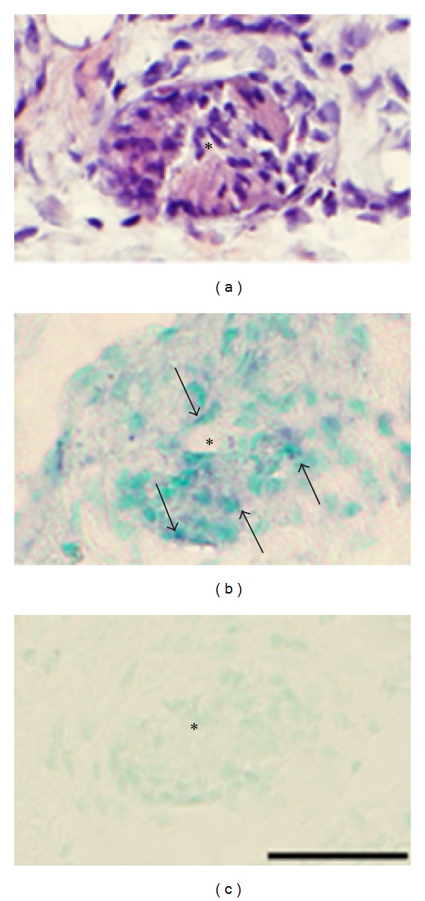 Figure 16