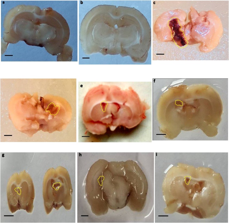 Fig. 10