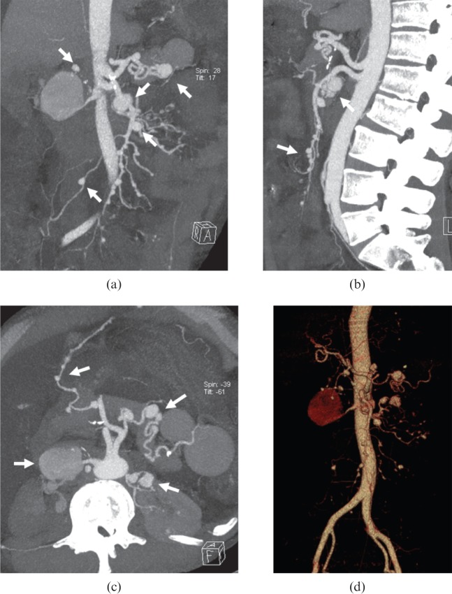 Figure 13