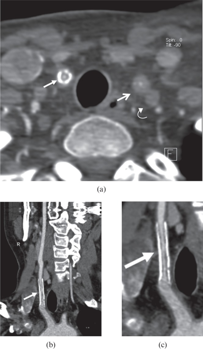 Figure 14