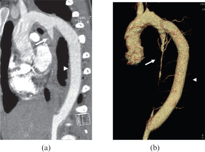 Figure 15