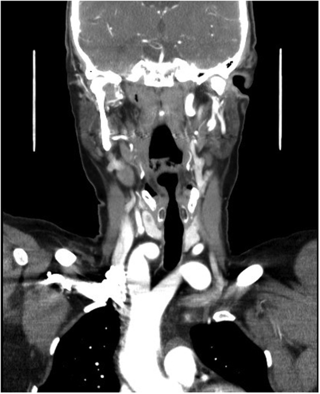 Figure 3: