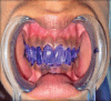 Fig. 3: