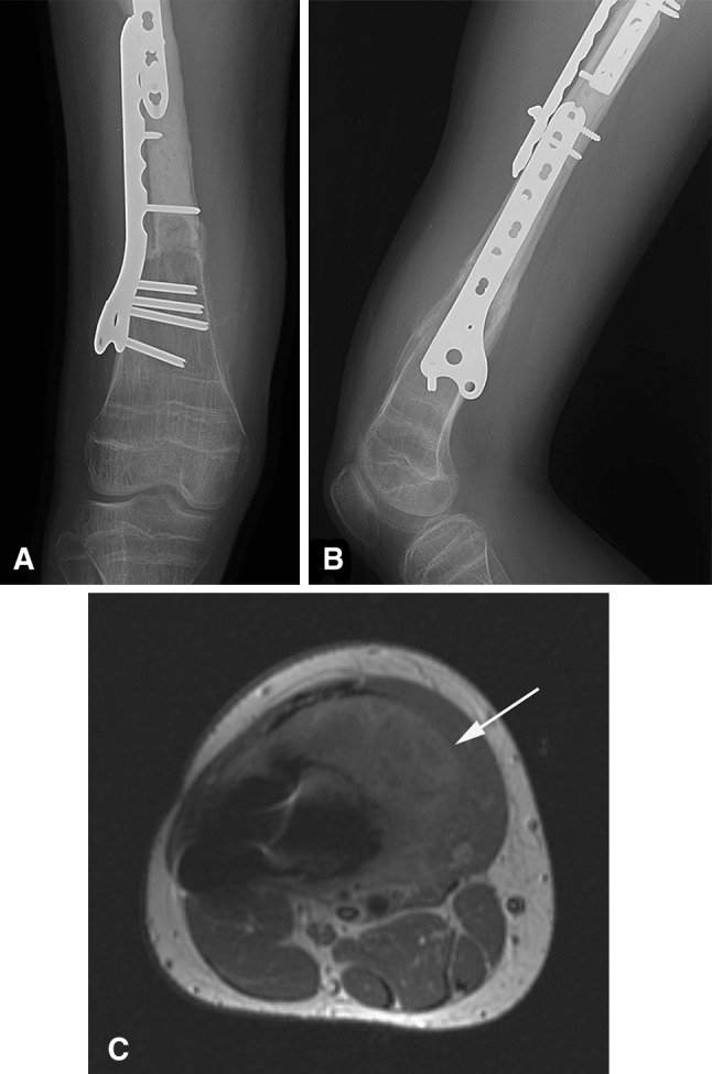 Fig. 1A–C